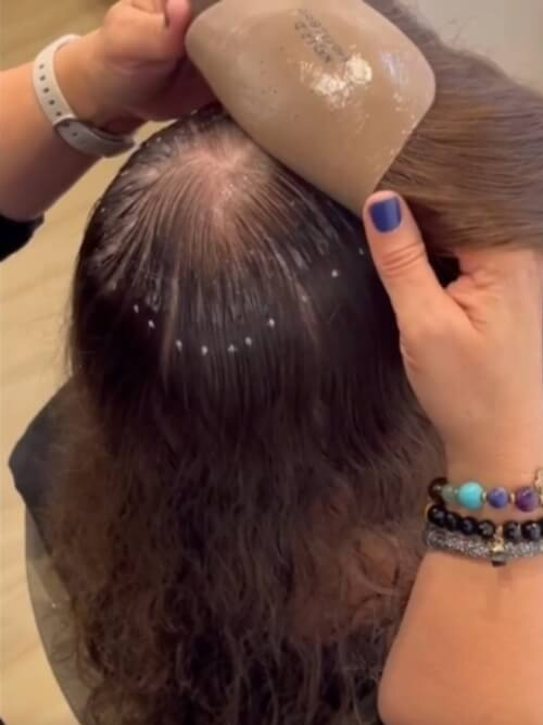 CNC hair replacement system being bonded to a person's head